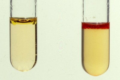 Indole test