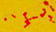 <p><strong>Fig. 57:2. </strong>Gram staining of <i>Actinobacillus pleuropneumoniae</i>, strain CCUG 12837T.</p>

<p> </p>