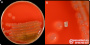 <p><strong>Fig. 81:1.</strong> Colonies of <i>Vibrio</i> <i>cholerae</i>, cultured aerobically on bovine blood agar at 37°C. Image A shows the whole plate and image B shows an enlargement of the plate. Date: 2025-08-30.</p>